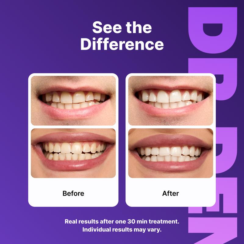 PureWhite™ Purple Strips
