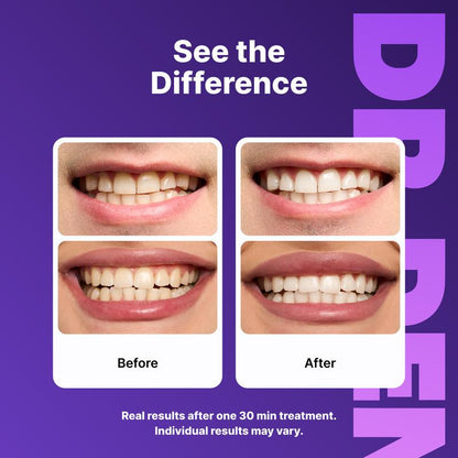 PureWhite™ Purple Strips